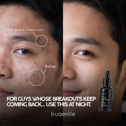 Retinol Night Serum