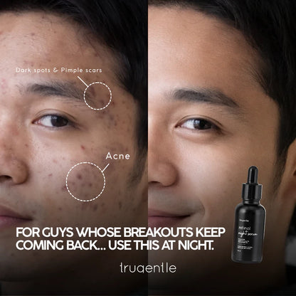 Retinol Night Serum