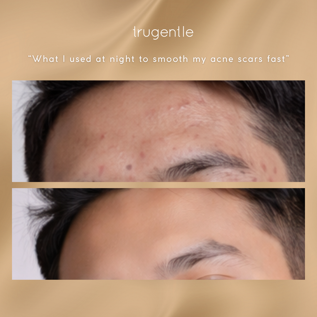 Retinol Night Serum