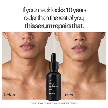 Retinol Night Serum